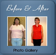 Weight Loss Before and After Gallery